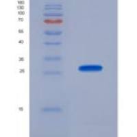 人苯丙氨酸羟化酶(PAH)重组蛋白