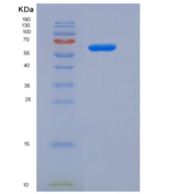 人无翅型MMTV整合位点家族成员2B(WNT2B)重组蛋白
