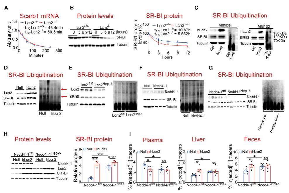 复旦大学徐延勇等团队发现动脉粥样硬化的关键调节因子