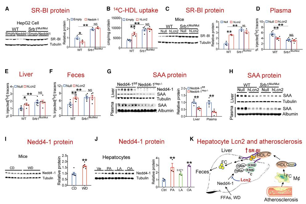 复旦大学徐延勇等团队发现动脉粥样硬化的关键调节因子