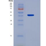 人白介素12B(IL12B)重组蛋白