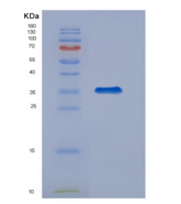 小鼠组织因子通道抑制因子(TFPI)重组蛋白