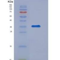 小鼠组织因子通道抑制因子(TFPI)重组蛋白