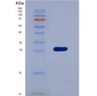 人白细胞免疫球蛋白样受体亚家族B成员3(LILRB3)重组蛋白