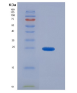 人紧密连接蛋白1(TJP1)重组蛋白
