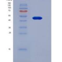 小鼠载脂蛋白D(APOD)重组蛋白