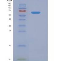 人层粘连蛋白β2(LAMb2)重组蛋白