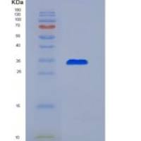 人肽基精氨酸脱亚氨酶Ⅲ(PADI3)重组蛋白