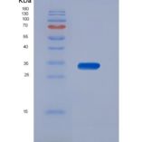 大鼠渗透性糖蛋白(Pgp)重组蛋白