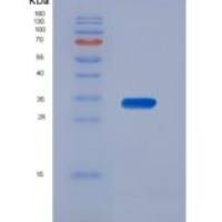 大鼠渗透性糖蛋白(Pgp)重组蛋白