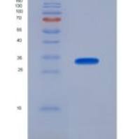 人CD56分子(CD56)重组蛋白