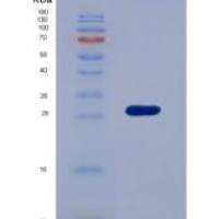 人心肌肌钙蛋白I(cTnI)重组蛋白