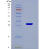 人组蛋白H1(H1)重组蛋白