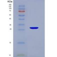 人组蛋白H1(H1)重组蛋白