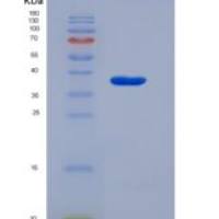 人溶质载体家族25成员39(SLC25A39)重组蛋白