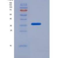 小鼠ATP结合盒转运蛋白G2(ABCG2)重组蛋白