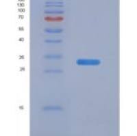 人神经纤维网蛋白2(NRP2)重组蛋白