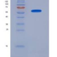 小鼠转化生长因子β受体Ⅲ(TGFbR3)重组蛋白