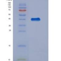 人肌酸激酶M+B (CKMB)重组蛋白
