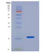 人骨膜蛋白(POSTN)重组蛋白