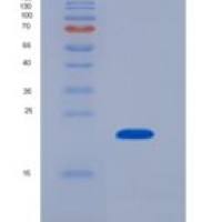 人磷酸肌醇-3-激酶催化亚基α肽(PIK3Ca)重组蛋白