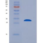 小鼠蛋白激酶,腺苷酸激活α1(AMPKα1)重组蛋白