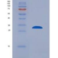 小鼠蛋白激酶，腺苷酸激活α1（AMPKα1）重组蛋白