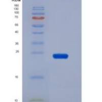 人白介素23α(IL23a)重组蛋白