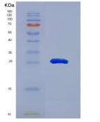 小鼠层粘连蛋白α2(LAMa2)重组蛋白