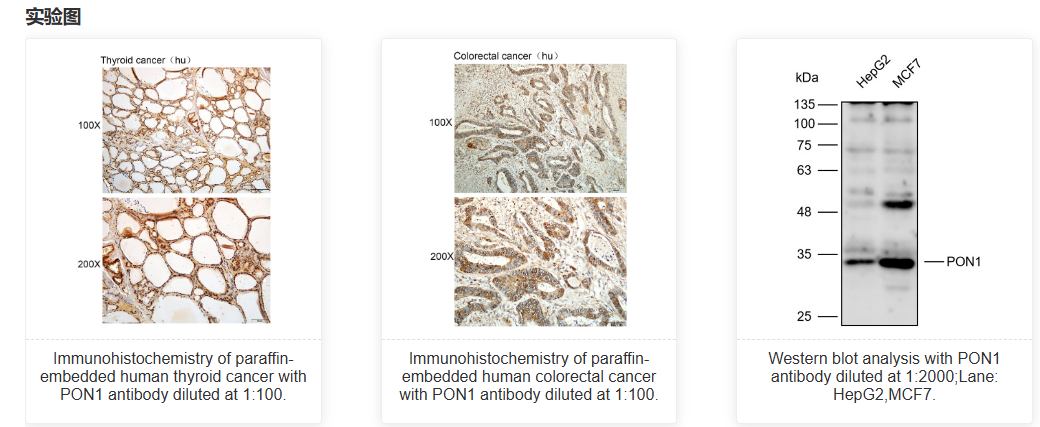 K113302P Anti-PON1 Polyclonal 