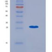 人踝蛋白(TLN1)重组蛋白