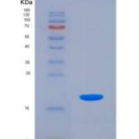 人白介素3受体α(IL3Ra)重组蛋白