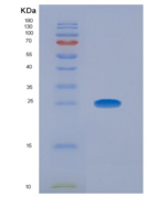 人癌胚抗原相关细胞粘附分子8(CEACAM8)重组蛋白