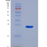 人载脂蛋白E(APOE)重组蛋白