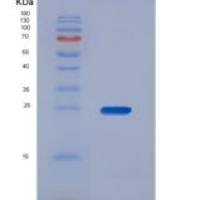 人Bcl2关联X蛋白(Bax)重组蛋白