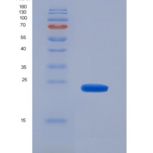 人CD8a分子(CD8a)重组蛋白