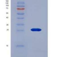 大鼠酶原颗粒膜糖蛋白(GP2)重组蛋白