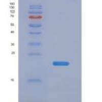 小鼠Nitric Oxide Synthase 2, Inducible (NOS2)重组蛋白