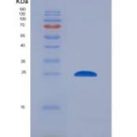 大鼠踝蛋白(TLN1)重组蛋白