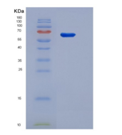 大鼠60kD热休克蛋白(Hsp60)重组蛋白