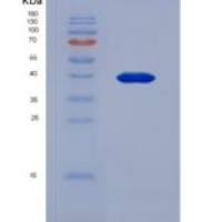 人骨骼肌慢肌肌钙蛋白T(TNNT1)重组蛋白