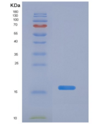人粘蛋白5B(MUC5B)重组蛋白
