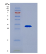 人血管内皮生长因子受体2(VEGFR2)重组蛋白
