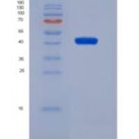 人Na+牛磺胆共转运多肽(NTCP)重组蛋白