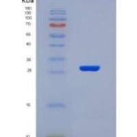 大鼠γ-氨基丁酸A受体β2(gABRb2)重组蛋白