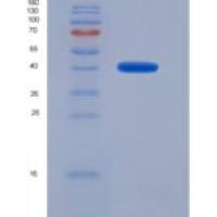 人酮戊二酸脱氢酶(OGDH)重组蛋白