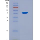 人ⅣD组磷脂酶A2(PLA2G4D)重组蛋白