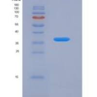 大鼠金属硫蛋白1(MT1)重组蛋白