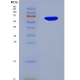 人穿孔素1(PRF1)重组蛋白