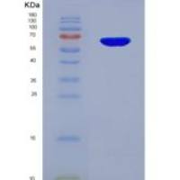 人穿孔素1(PRF1)重组蛋白